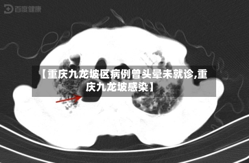 【重庆九龙坡区病例曾头晕未就诊,重庆九龙坡感染】